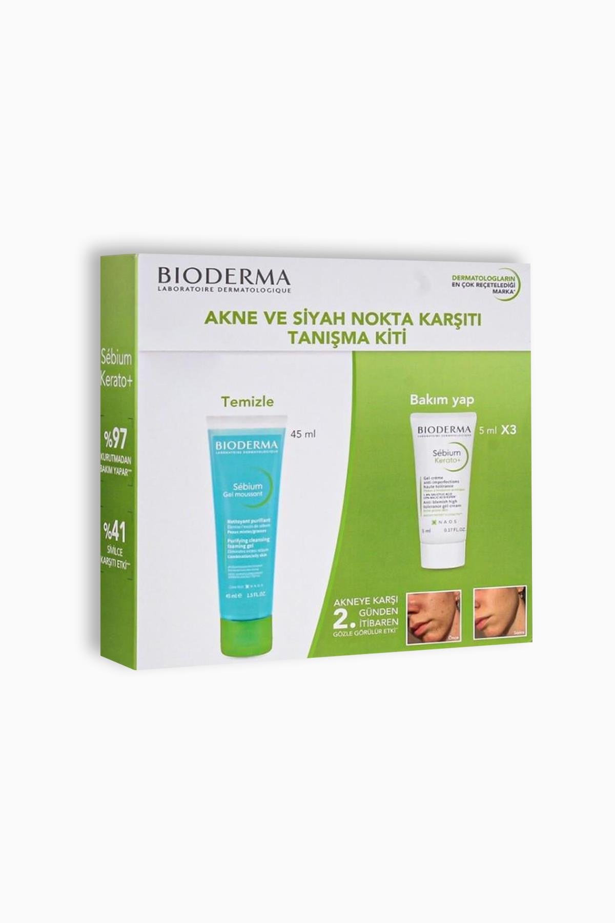 Bioderma Akne ve Siyah Nokta Karşıtı Tanışma Kiti-Sebium Jel 45 ml+Sebium Kerato 5 ml