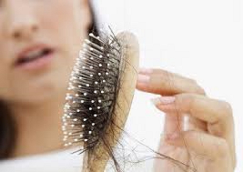 Kadınlarda Saç Dökülme Sebepleri Nelerdir?