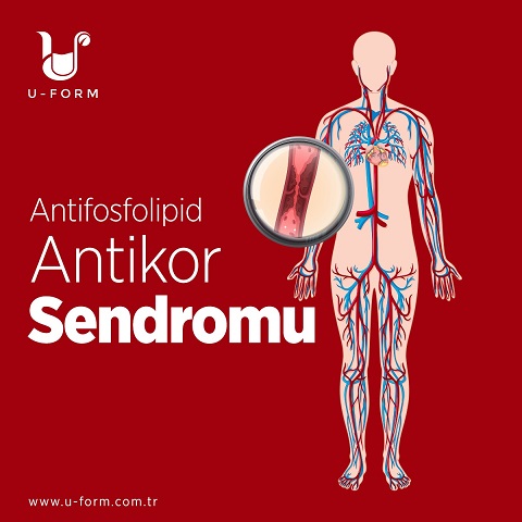 Antifosfolipid Antikor Sendromu
