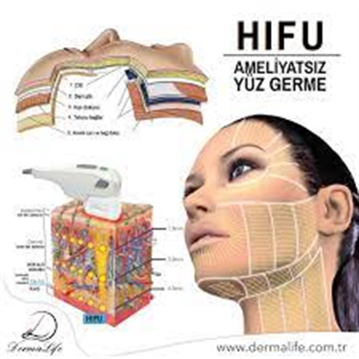 Profesyonel HIFU Cihazı 7D 2 Başlıklı