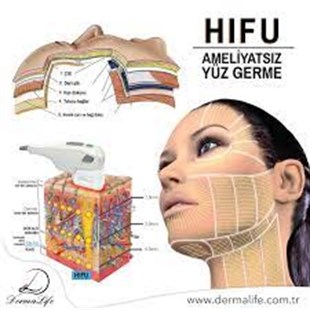 Profesyonel HIFU Cihazı 7D 2 Başlıklı