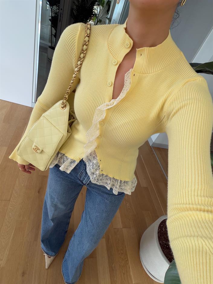 Dantel Detaylı Tasarım Hırka - Sarı