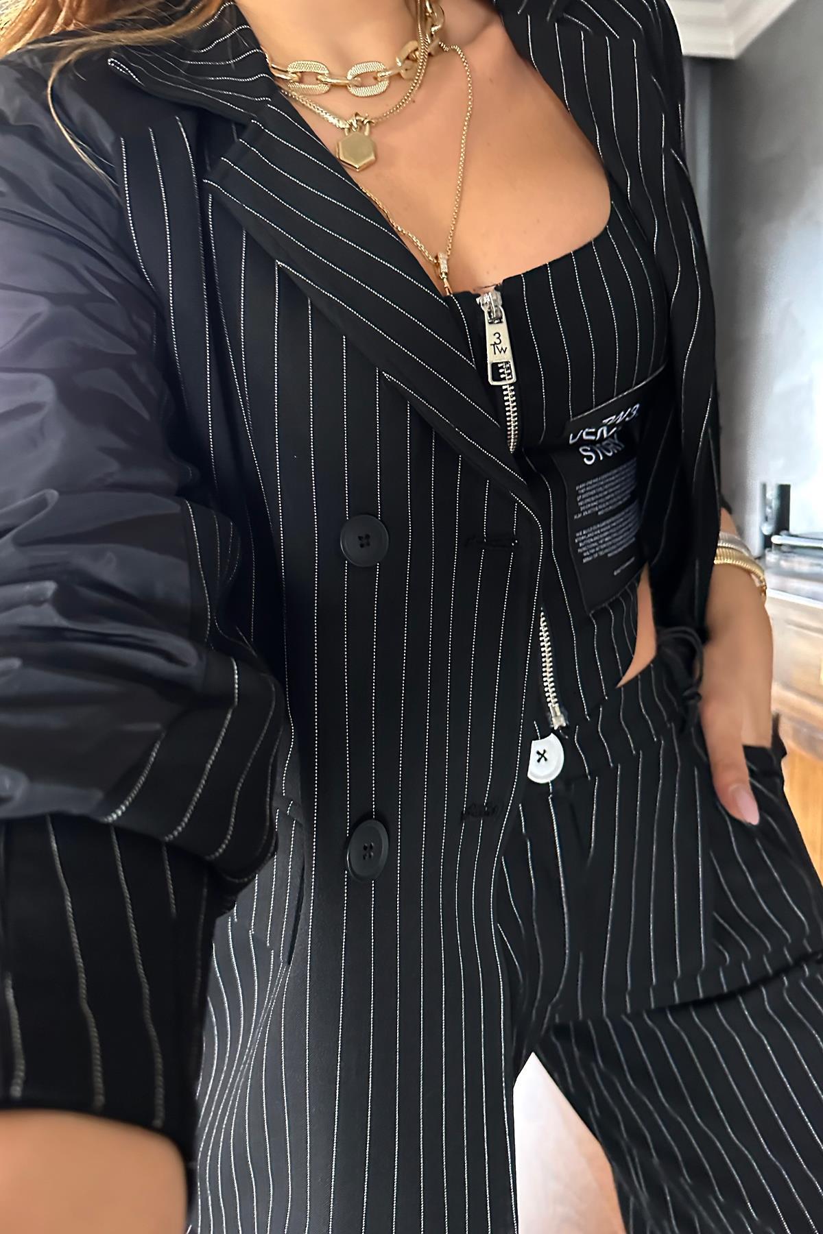 Tasarım Yağmurluk Kollu Blazer Ceket Siyah-Beyaz