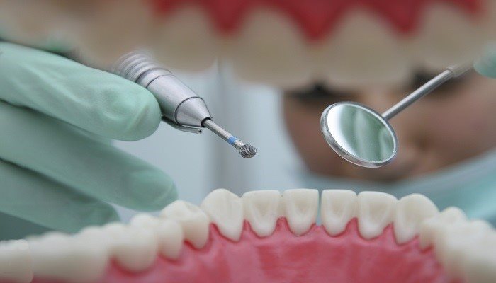 Diş Kliniklerinde En Çok Tercih Edilen 10 Diş Hekimliği Sarf Malzemesi Nedir?