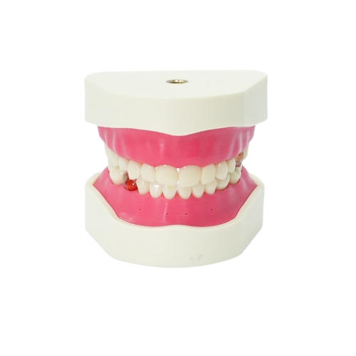 Edudent PedoPrep® Alt ve Üst Çene