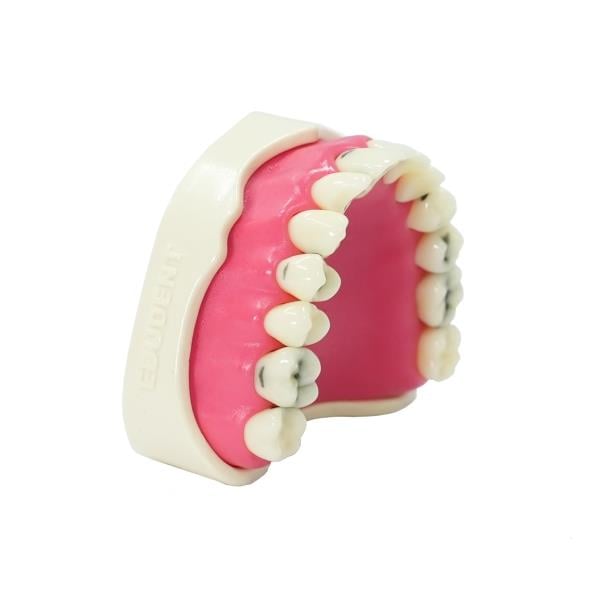 Edudent Resto Prep® Çürüklü Tek Çene