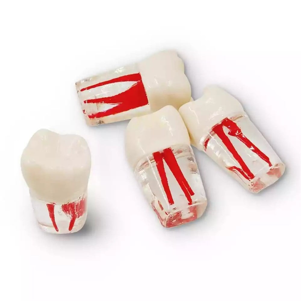 Endodontik Kanallı Kronlu Dişler