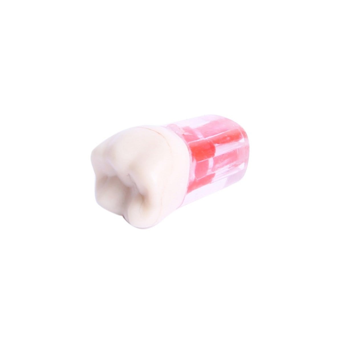ENDODONTİK  KRONLU MOLAR DİŞLER 