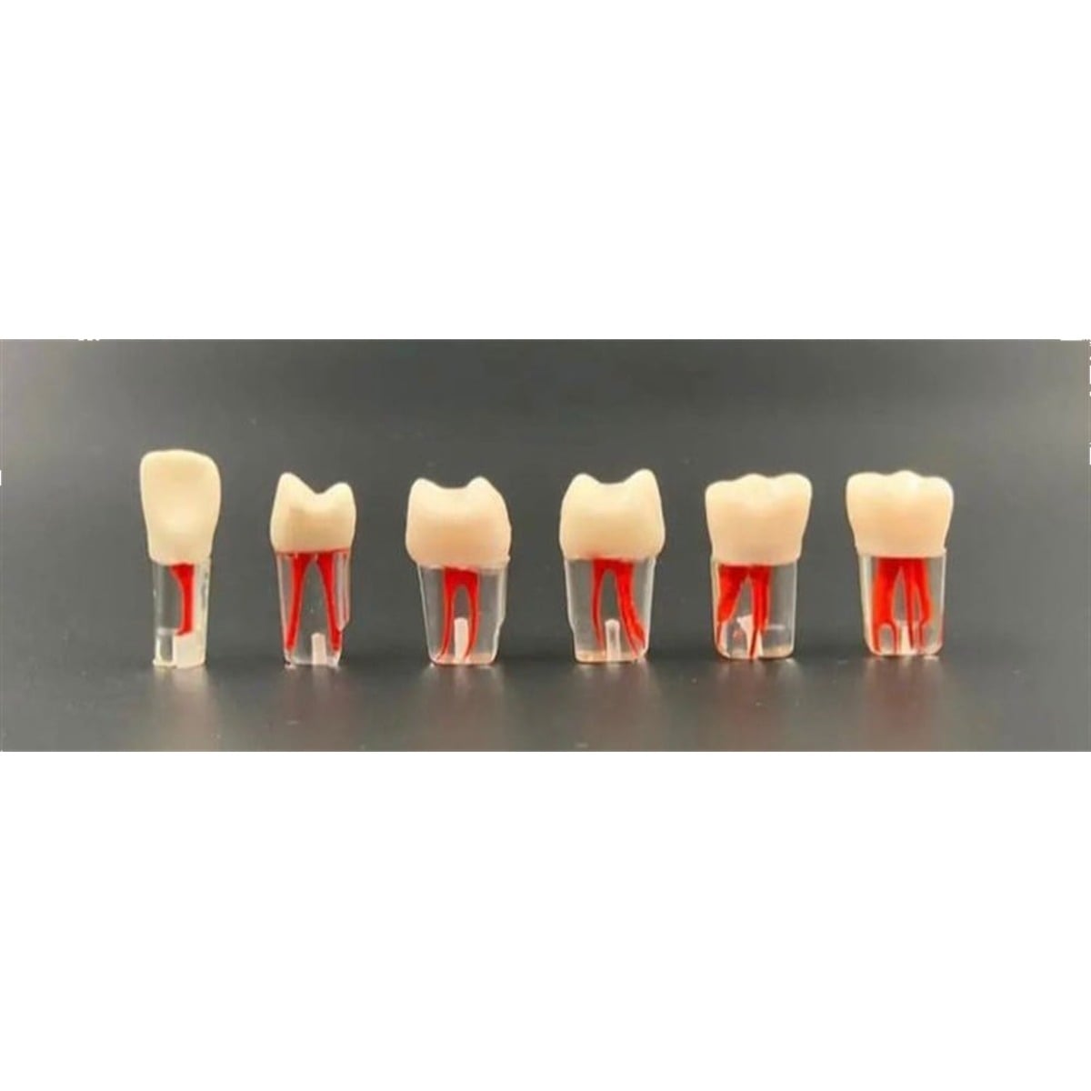 Omega Endodontik Kronlu Kanallı Dişler