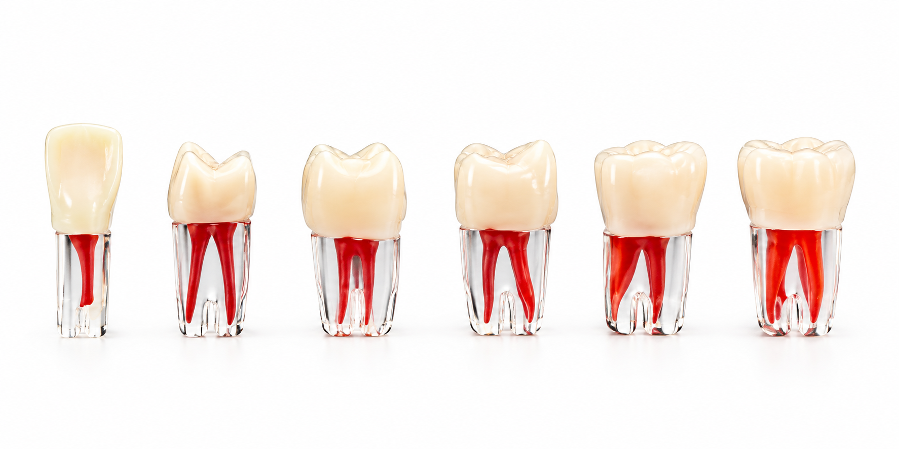 Omega Endodontik Kronlu Kanallı Dişler