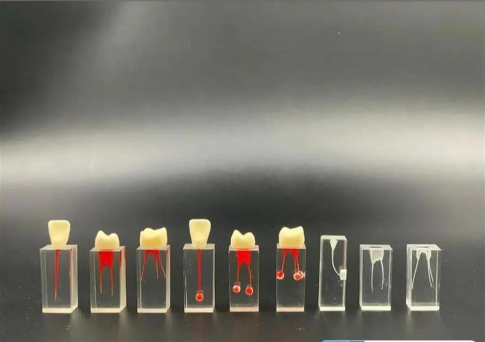 ENDODONTİK KARE KRONLU VE PULPALI DİŞLER