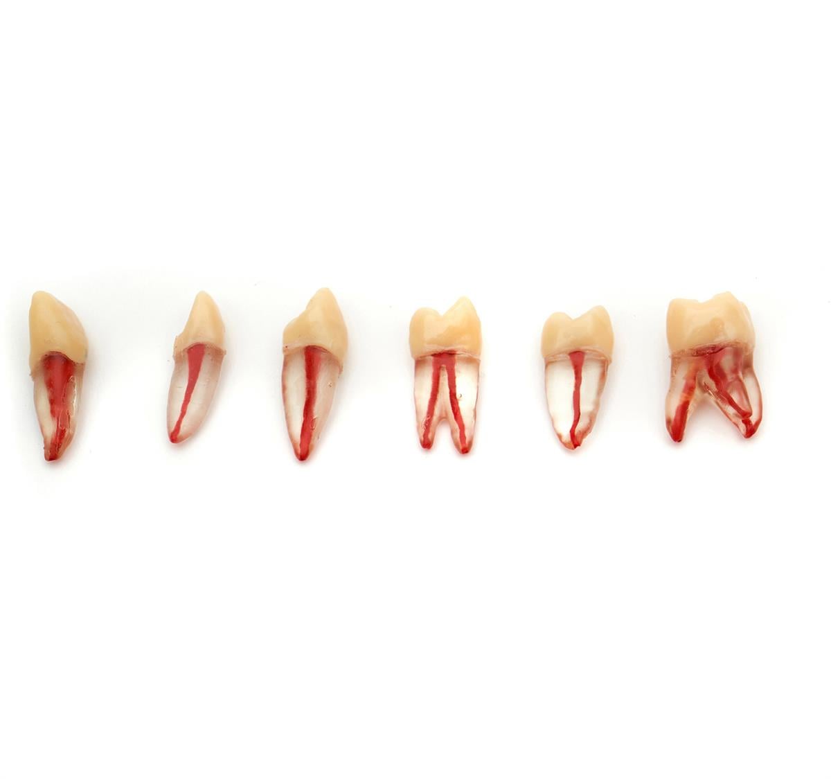 Endodontik Kronlu Şeffaf Diş Ayrı Köklü