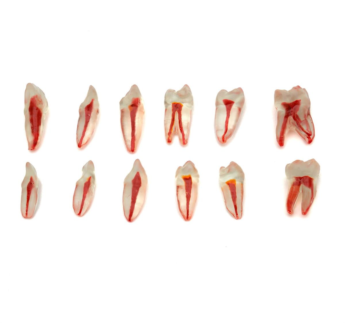 Endodontik Şeffaf Kanallı Köklü Dişler