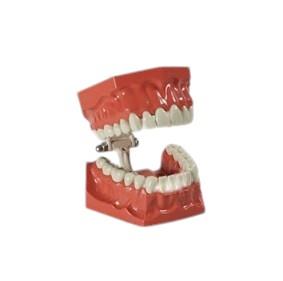 İntegra Sert Fantom Çene