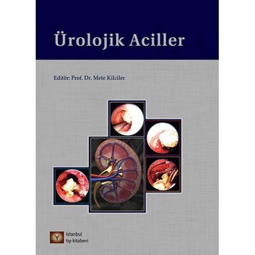Ürolojik Aciller