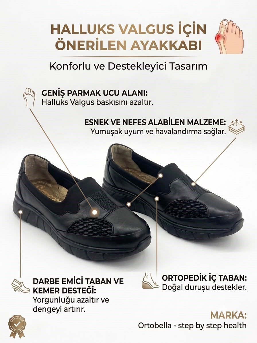 Ortobella Baş Parmak Kemik Çıkıntılı Günlük Doğal Deri Comfort Kadın Ayakkabı 823691