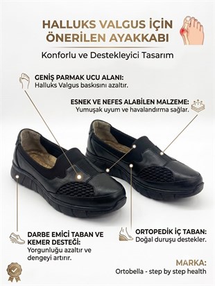 Ortobella Baş Parmak Kemik Çıkıntılı Günlük Doğal Deri Comfort Kadın Ayakkabı 823691