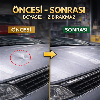 Polham 20 Parça Boyasız Göçük Düzeltme Seti | Kaput Kapı Çamurluk Göçük Onarım Aparatı | PDR Dent Repair Seti