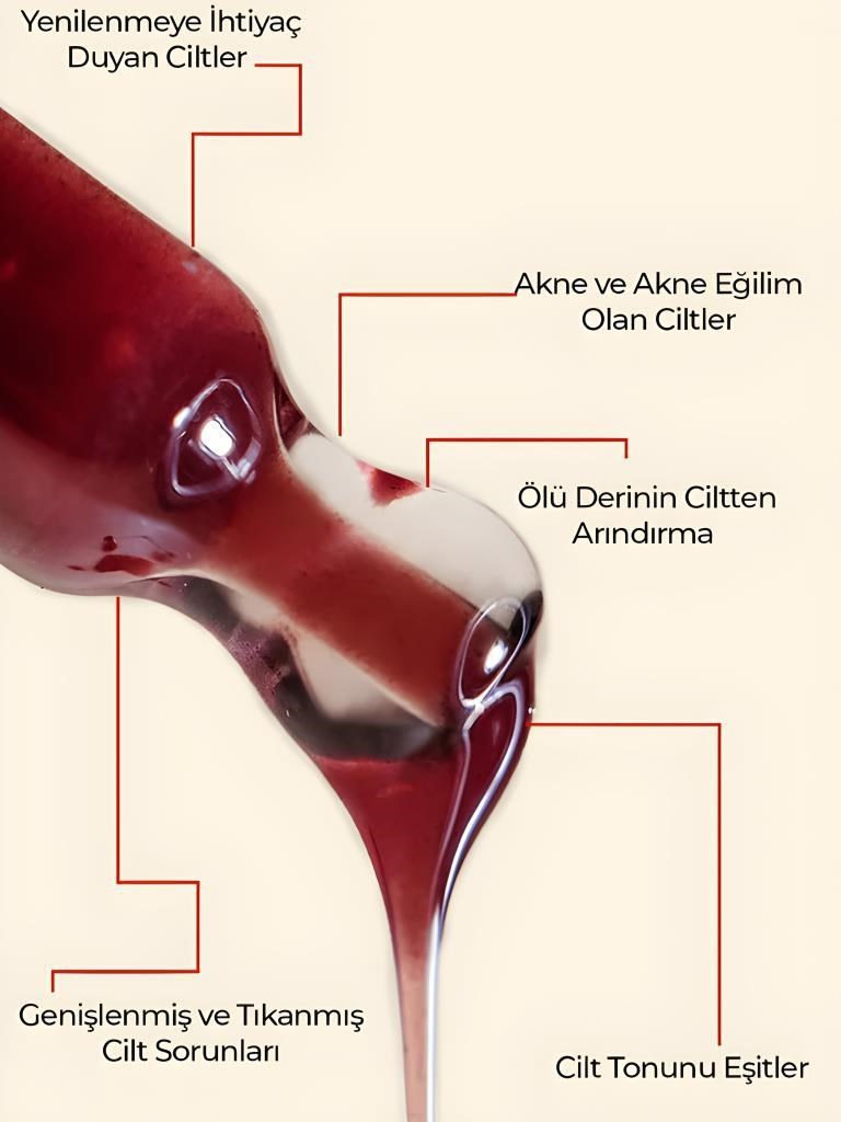 Ronna Beauty Akneli Cilt Düzenleyici Red Peeling Serum 30 ml AHA 15%+BHA 2% pH3.8