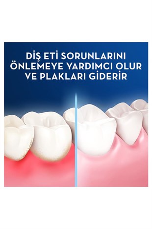 Oral-B Pro Expert Advanced Sağlıklı Diş Etleri 25 M