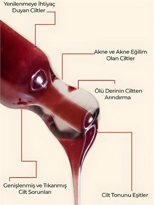 Ronna Beauty Akneli Cilt Düzenleyici Red Peeling Serum 30 ml AHA 15%+BHA 2% pH3.8