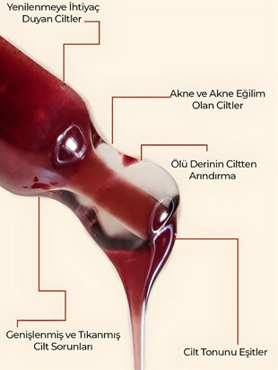 Ronna Beauty Akneli Cilt Düzenleyici Red Peeling Serum 30 ml AHA 15%+BHA 2% pH3.8
