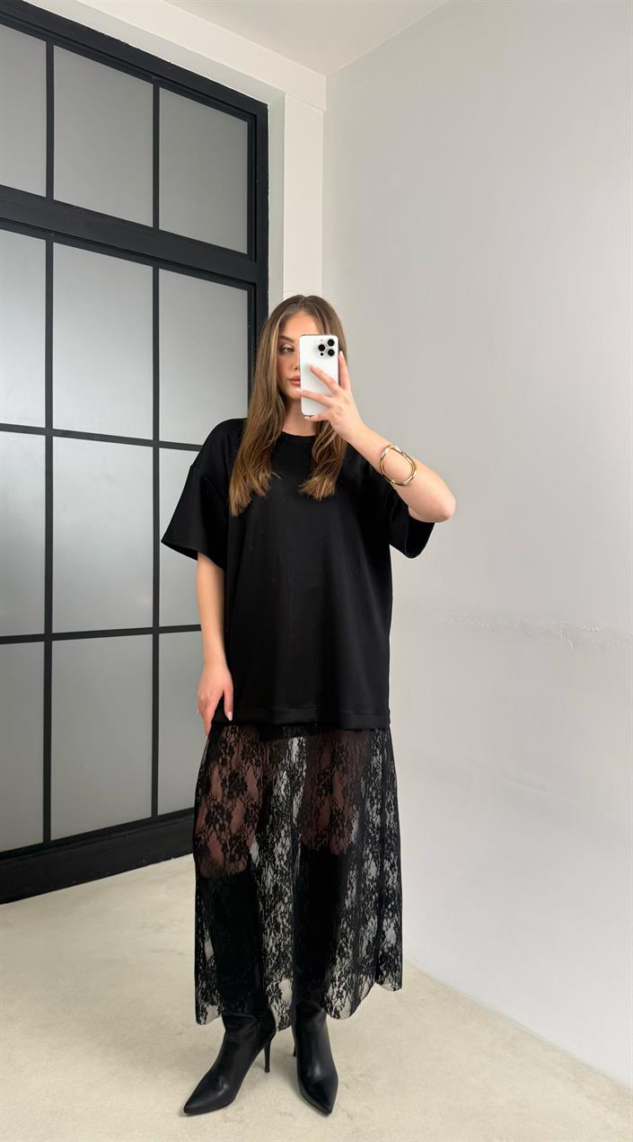 Siyah Dantel Detaylı Modal Kumaş Elbise GAUS-01105