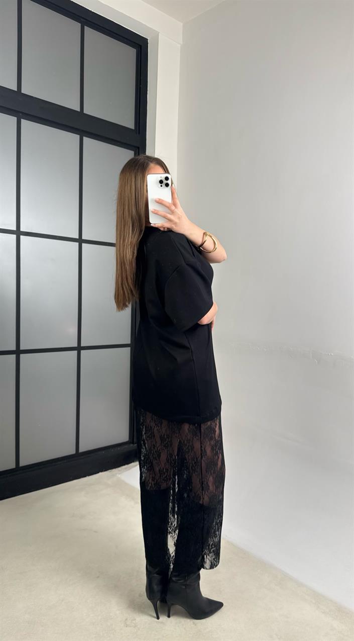 Siyah Dantel Detaylı Modal Kumaş Elbise GAUS-01105