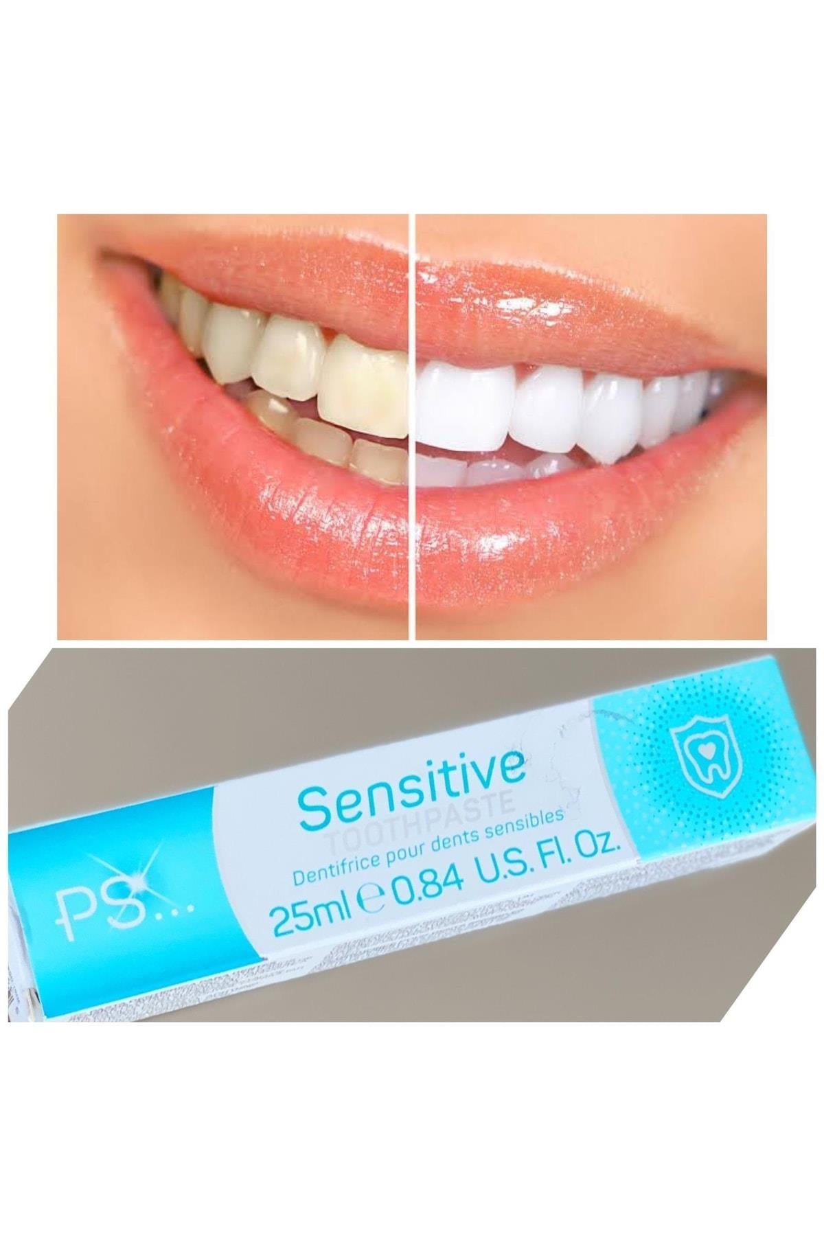 Ingiltere’den 1 Numaralı Diş Beyazlatıcı Sensitive Toothpaste Diş Macunu