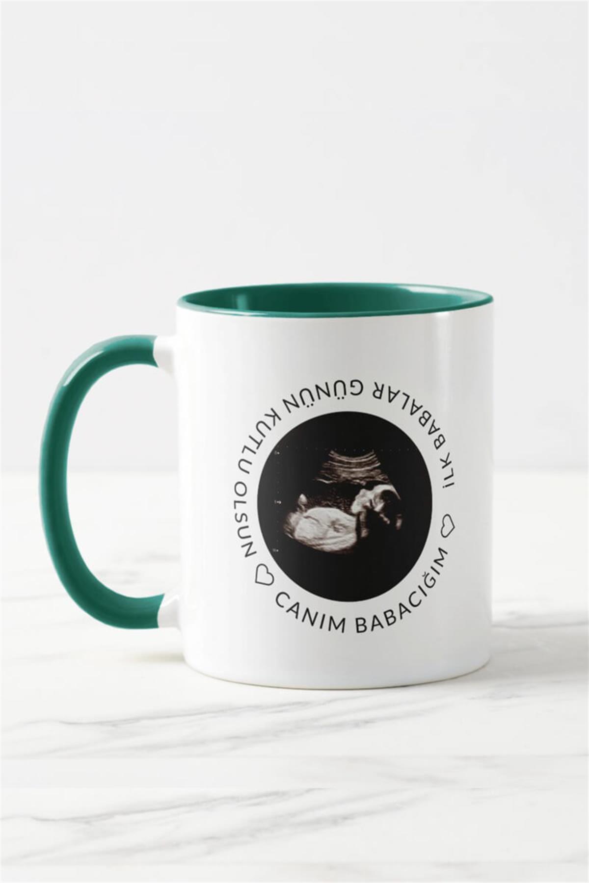 Baba Adayına Babalar Günü Hediyesi Ultrason Fotoğraflı Renkli Kupa Bardak