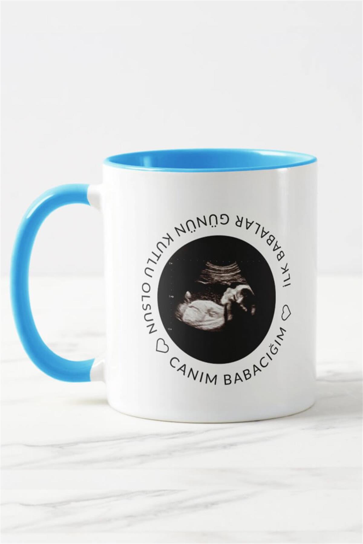 Baba Adayına Babalar Günü Hediyesi Ultrason Fotoğraflı Renkli Kupa Bardak