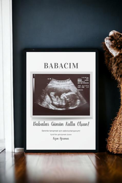 Yeni Baba Adayına Babalar Günü Hediyesi Ultrason Tasarım Hediyelik Çerçeve