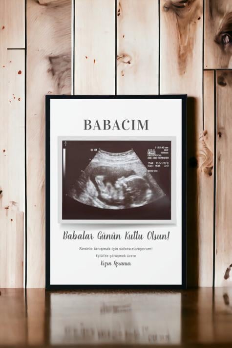 Yeni Baba Adayına Babalar Günü Hediyesi Ultrason Tasarım Hediyelik Çerçeve