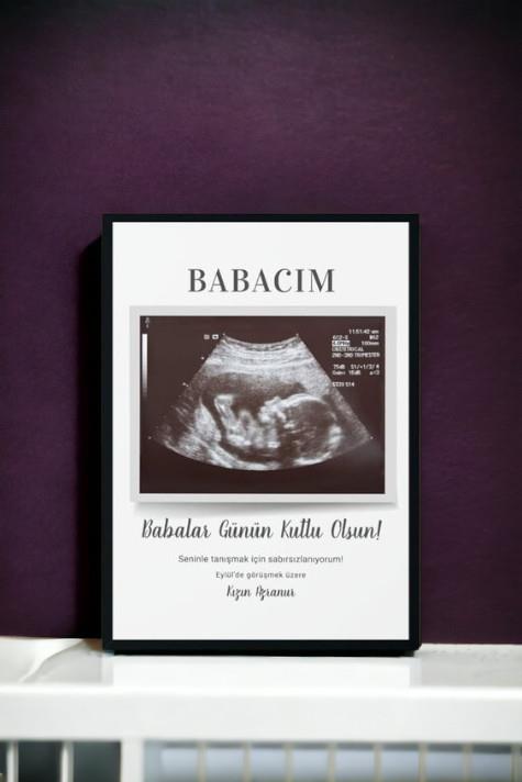 Yeni Baba Adayına Babalar Günü Hediyesi Ultrason Tasarım Hediyelik Çerçeve