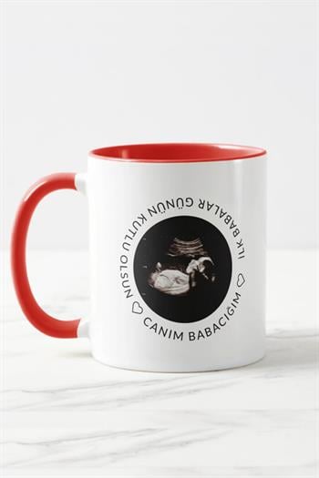 Baba Adayına Babalar Günü Hediyesi Ultrason Fotoğraflı Renkli Kupa Bardak