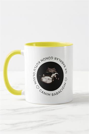 Baba Adayına Babalar Günü Hediyesi Ultrason Fotoğraflı Renkli Kupa Bardak