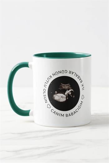 Baba Adayına Babalar Günü Hediyesi Ultrason Fotoğraflı Renkli Kupa Bardak