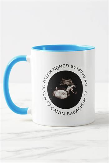 Baba Adayına Babalar Günü Hediyesi Ultrason Fotoğraflı Renkli Kupa Bardak