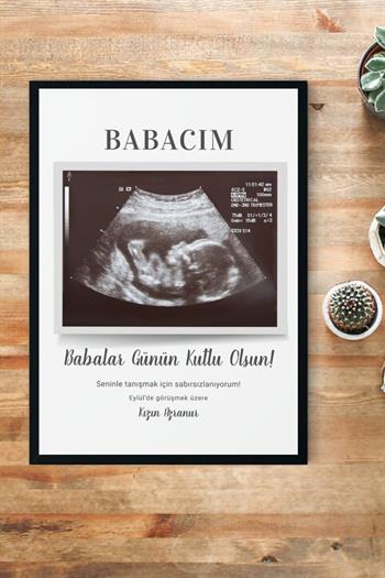 Yeni Baba Adayına Babalar Günü Hediyesi Ultrason Tasarım Hediyelik Çerçeve