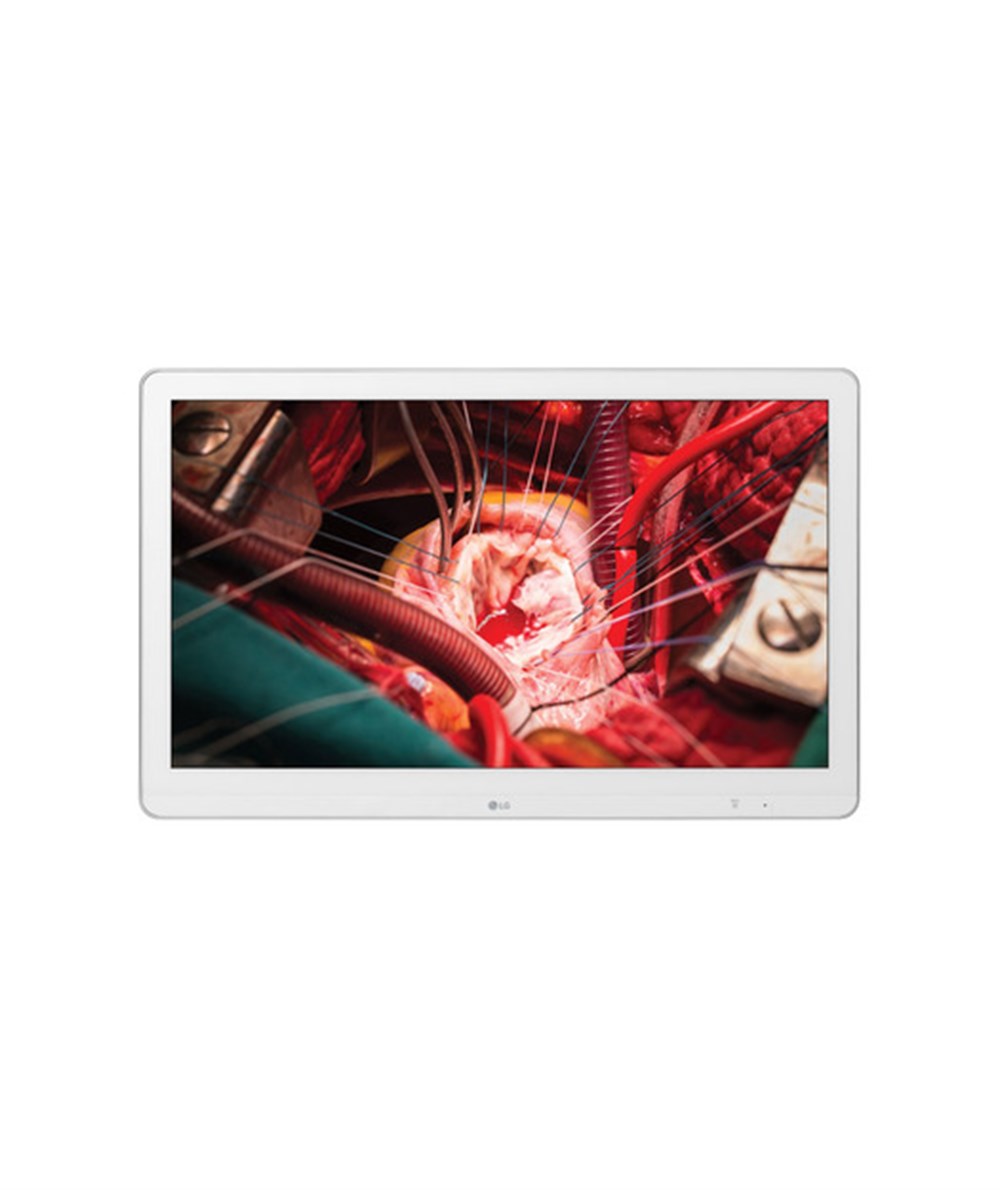 LG 27 27HK510S-W  Cerrahi Monıtor FHD,IPS