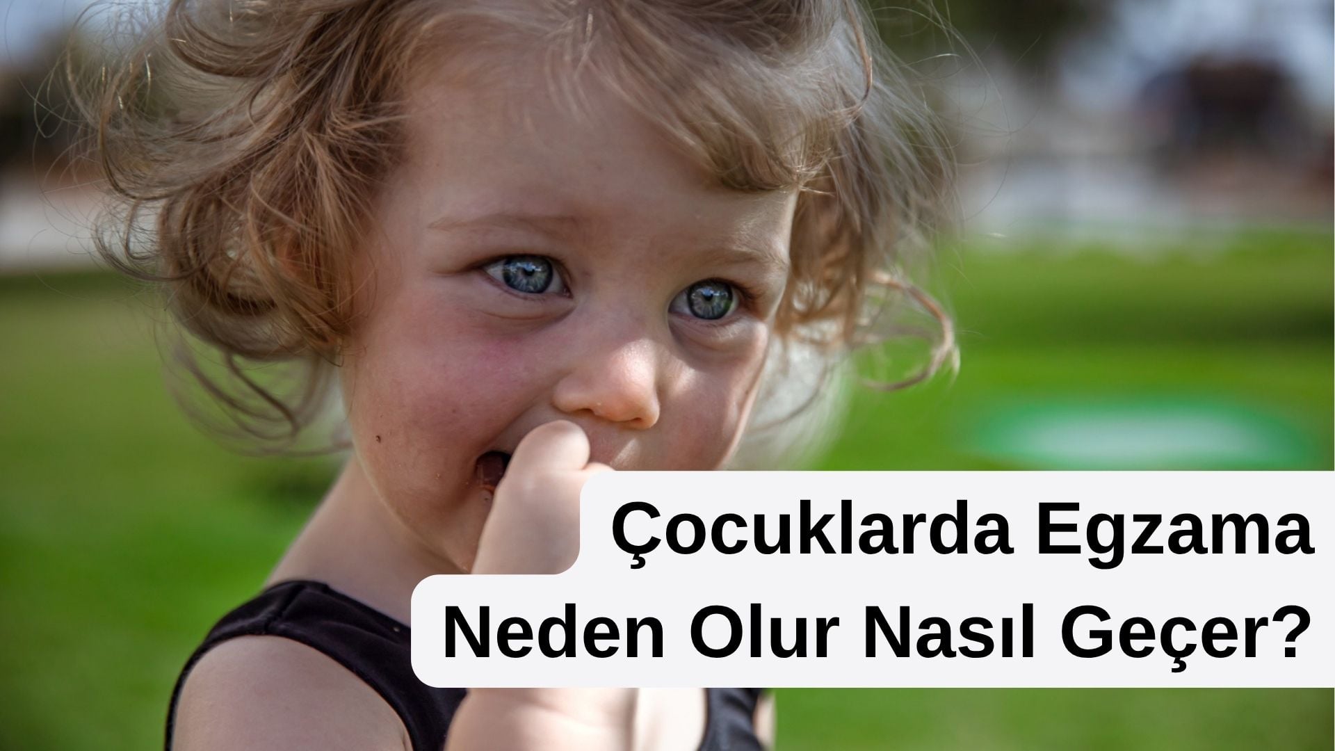 çocuklarda egzama