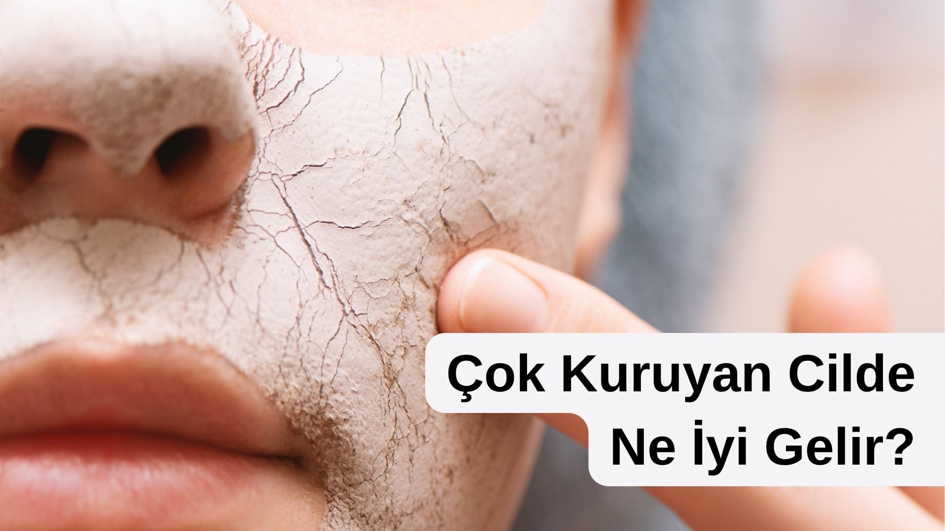 çok kuruyan cilde ne iyi gelir