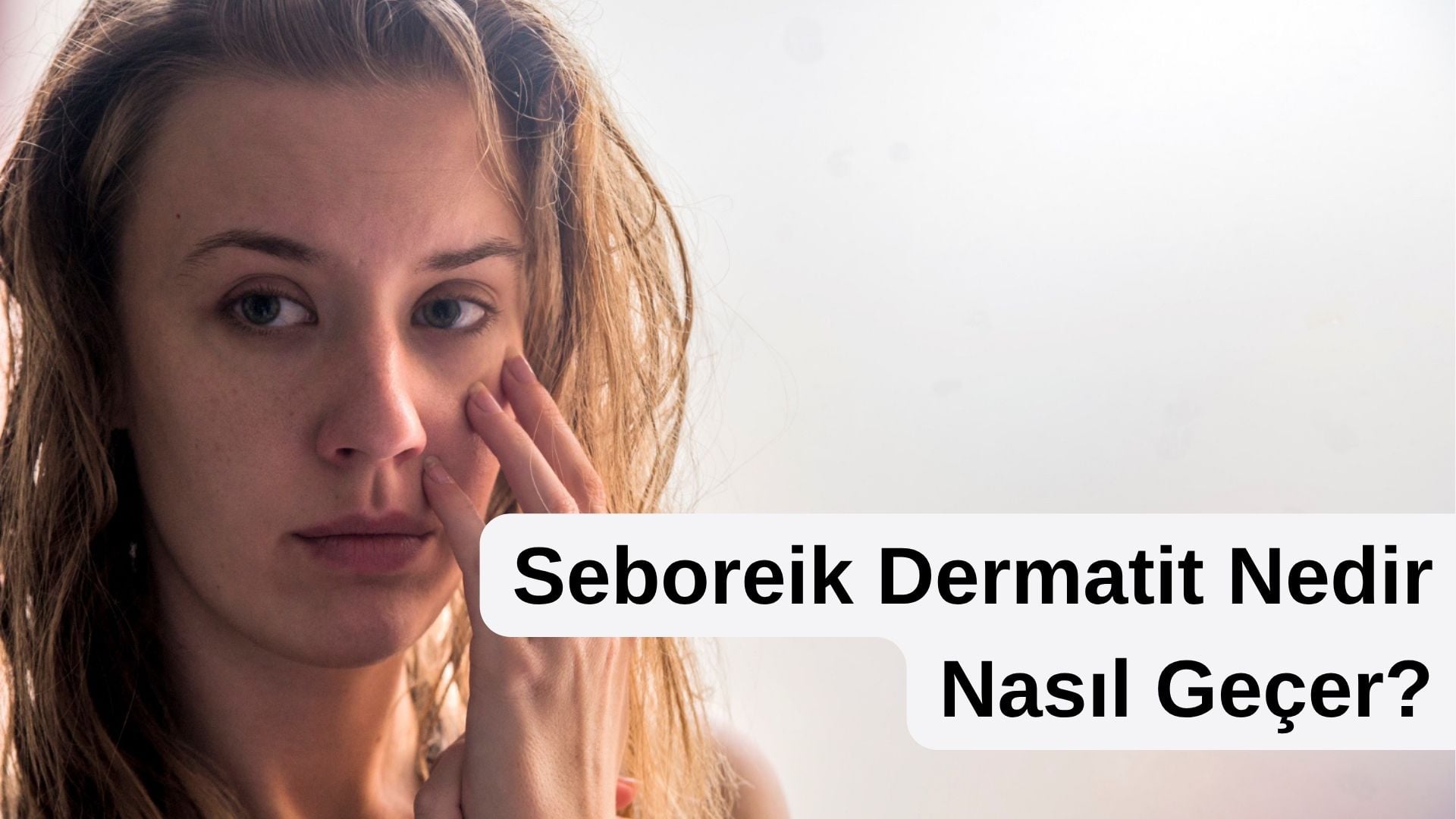 seboreik dermatit