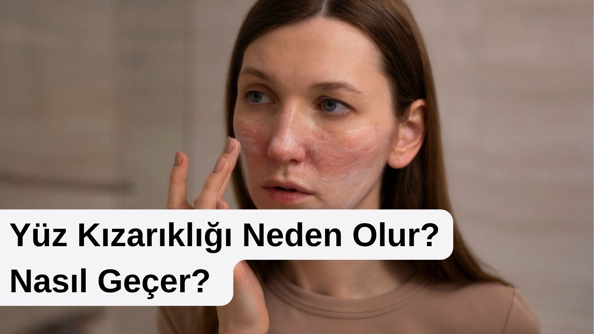 yüz kızarıklığı