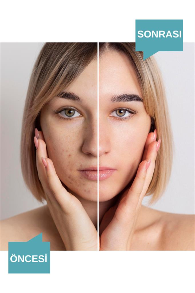 NOADERMA Noac Cilt Bakım Serumu 30 ml