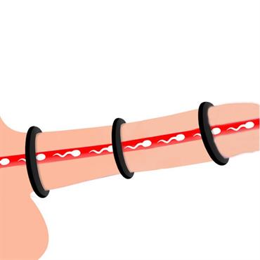 Mavi Penis Halkası Seti 3 Boy