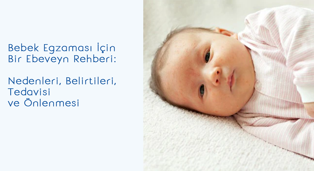 Bebek Egzaması İçin Bir Ebeveyn Rehberi: Nedenleri, Belirtileri, Tedavisi ve Önlenmesi