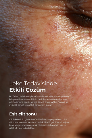 TTO Clinic Leke Kremi 75 ml