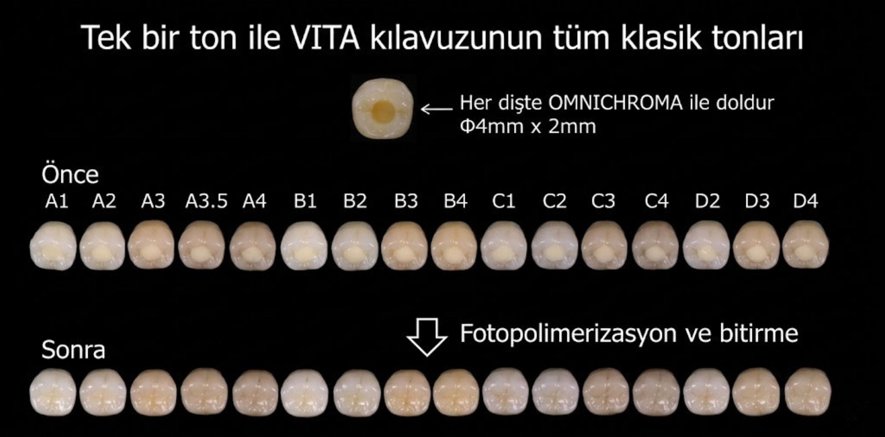 Omnichroma Kutu ve Şırınga