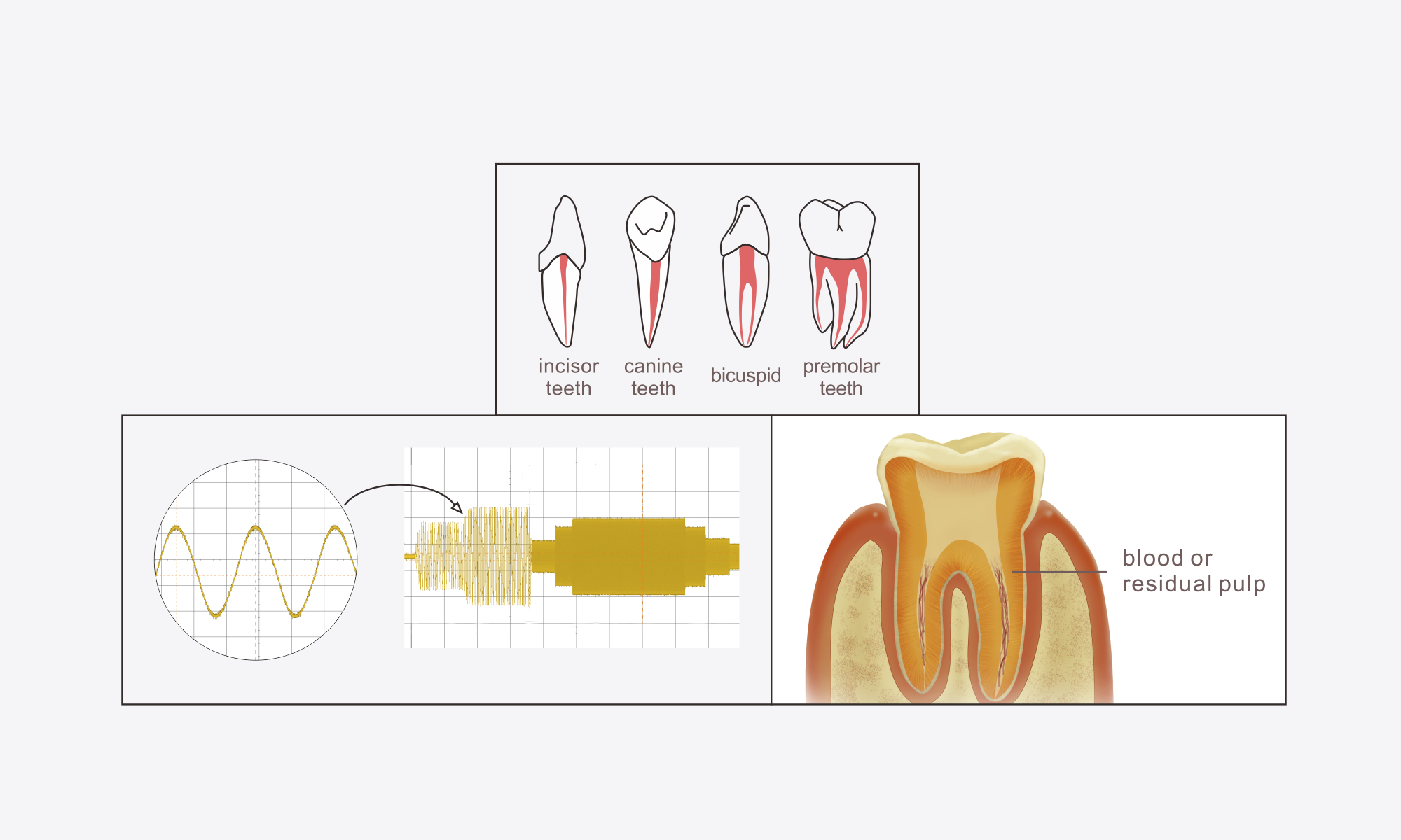 Multi-frequency apical position technology